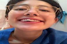 女友有点龅牙